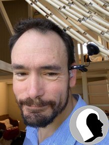 CI Kopf 2022 männlich